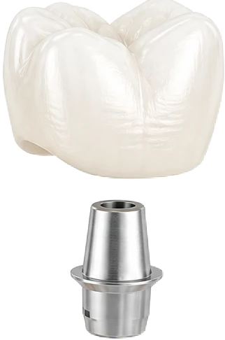 Üst Parça